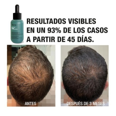 Tahe Programa profissional anti queda: Concentrado 50 ml + Champô Peptídeo T98 Tahe Programa profissional anti queda: Concentrado 50 ml + Champô Peptídeo T98