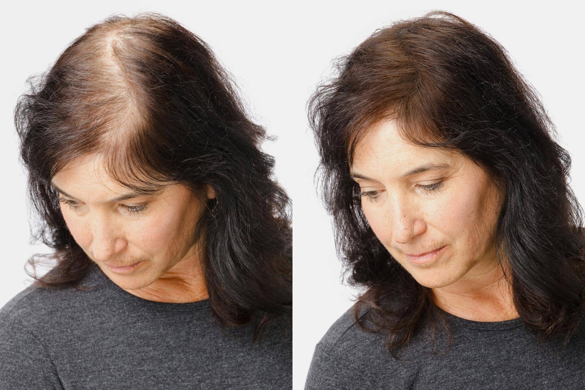 NISHMAN KERATIN FIBERS BLACK / PRETO + SPRAY FIXADOR NMN-160-BLA