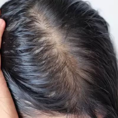 Couro cabeludo com cabelo preto molhado e mão segurando a cabeça