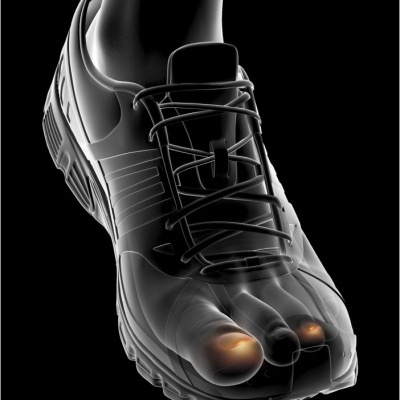 Epitact Sport Proteção de Unhas Tam. L