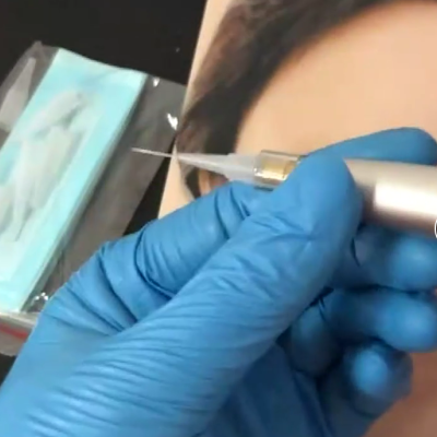 Kit Agulhas + Ponteira Para Dermógrafo Universal 50 Und