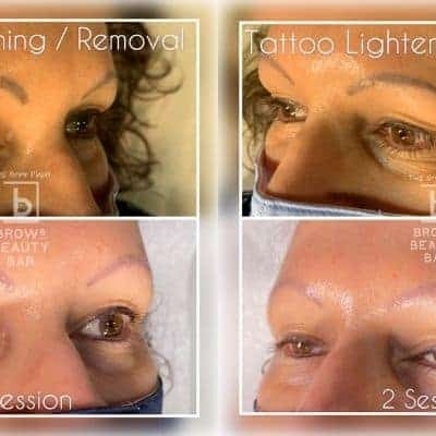 Lift Despigmentante Profissional – 15ml