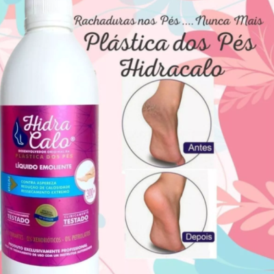 Hidracalo 300ml Loção Emoliente - Plástica dos Pés