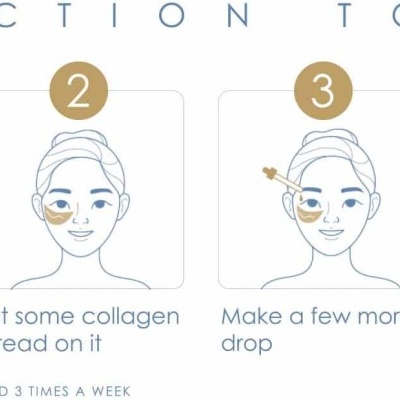 Fios de Colagénio de Seda 240 Und