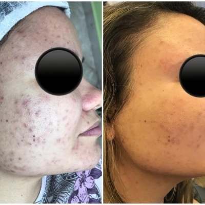 Kit Profissional Rose de Mer