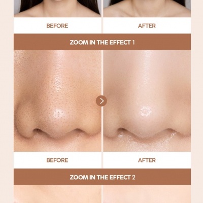 Kit Tok Tok Medisco Stayve