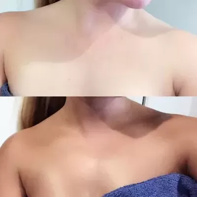 Solução de Bronzeamento Profissional Coconut Water Pro Spray Mist