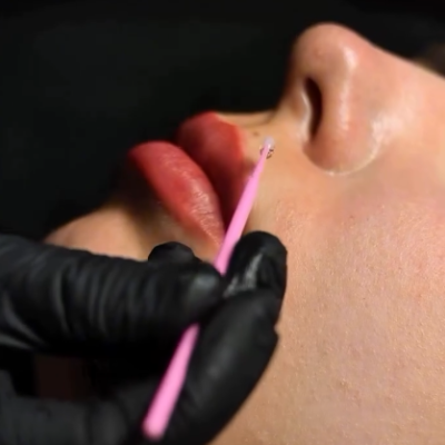 Stop Red (Anti-Edema Gel) Durante e Pós Micro – AS Company