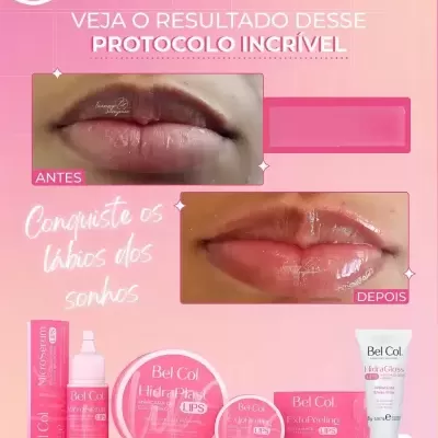 Kit Hidra Lips Tratamento Labial Hidragloss - Bel Col