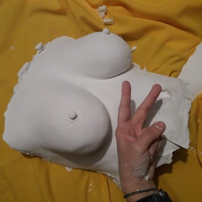Breast