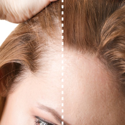 Perfect&#x20;Beauty&#x20;-&#x20;Fibras&#x20;capilares&#x20;Castanho