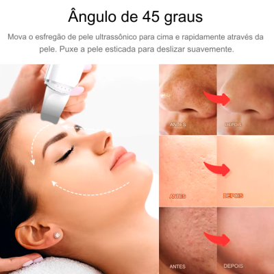 Espátula de Peeling Ultrassónico