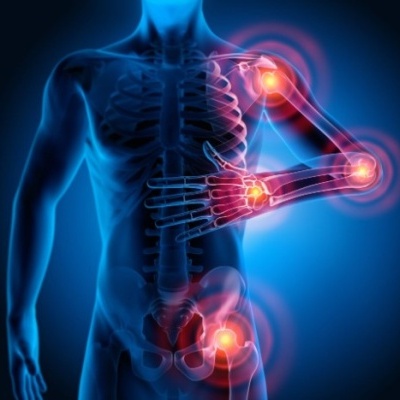 Sistema musculoesquelético