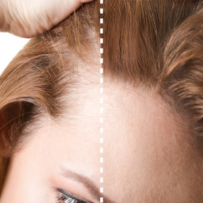 Perfect Beauty - Fibras capilares Preto