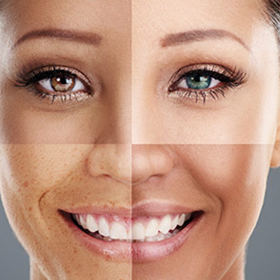 Peles Normais e todos os tipos