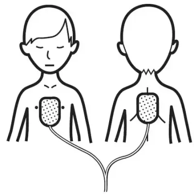 Eléctrodos Pediátricos Defibtech Lifeline