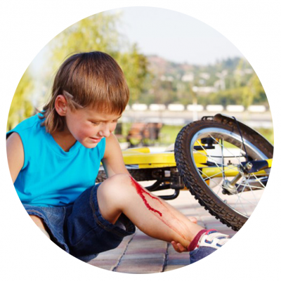 Criança com machucado no joelho ao lado de bicicleta caída.