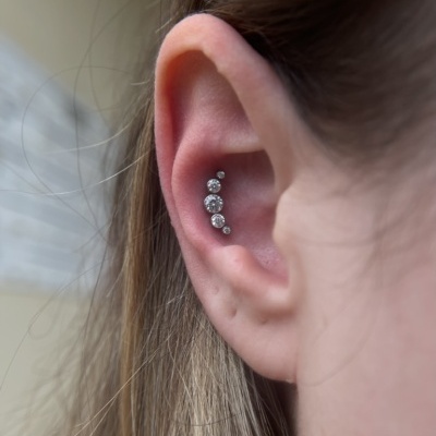 Cluster com 5 zircónias