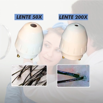 Dermascope para couro cabeludo e pele | Ref.864233