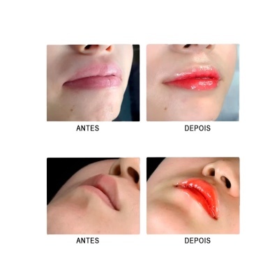 Kit BB-Lip Coloring Serum, coloração labial | Ref.SZ01788 Kit BB-Lip Coloring Serum, coloração labial | Ref.SZ01788
