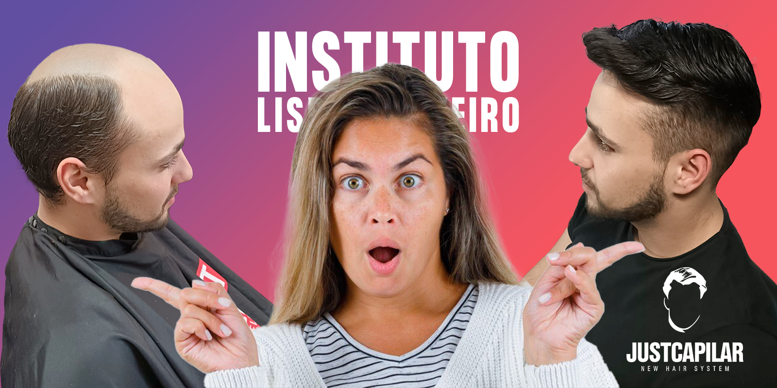 Colocação de Prótese Capilar: Naturalidade, Conforto e Estilo | Just Capilar