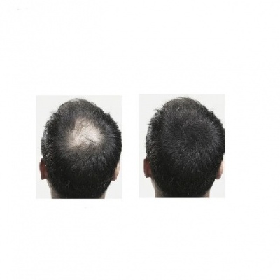 Fibras capilares de algodão LuxHair, para correção da alopecia, cor preta - 25g
