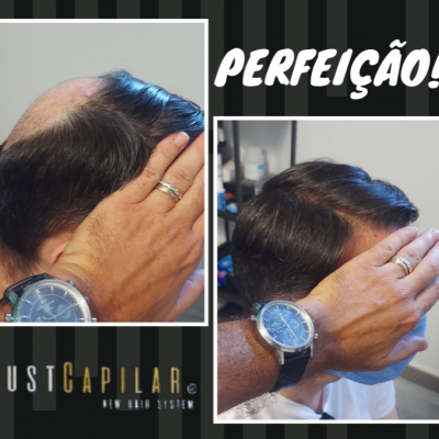 Clínica Justcapilar em Lisboa