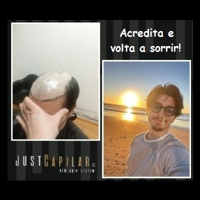 Clínica Justcapilar em Lisboa