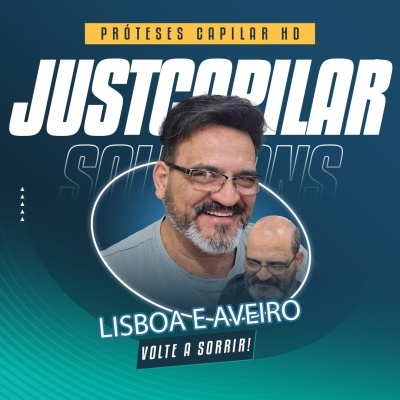 Prótese Capilar M-pele Com Colocação e Corte.