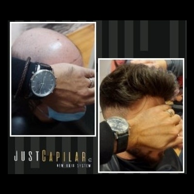 Clínica Justcapilar em Lisboa