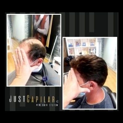 Clínica Justcapilar em Lisboa
