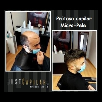 Clínica Justcapilar em Lisboa