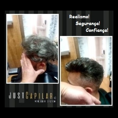 Clínica Justcapilar em Lisboa