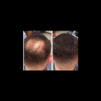 Bunee, fibras capilares, top 100% para correção da alopecia, cor loiro claro 27.5g