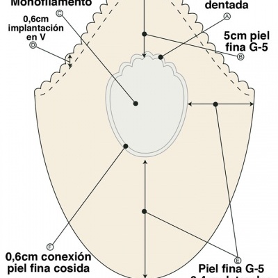 Prótese Capilar HORUS Capel-lo - By Aderans.