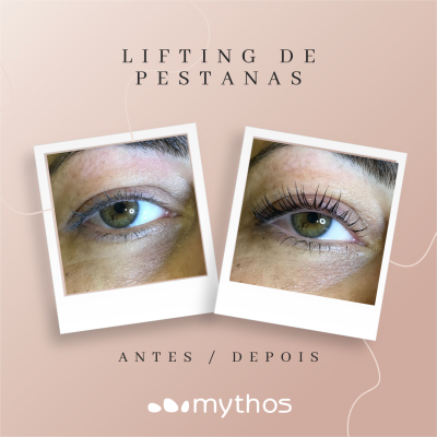 Lifting de Pestanas