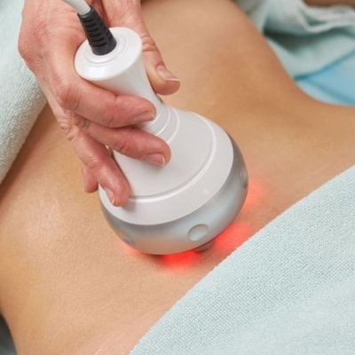 Radiofrequência  Corpo