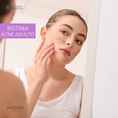 Kit Skincare Acne Adulto