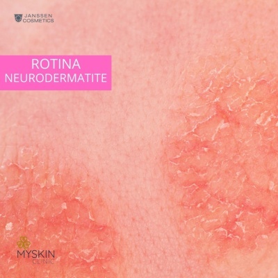 Kit Skincare Dermatite