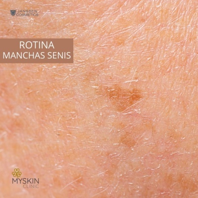 Kit Skincare Aclarante