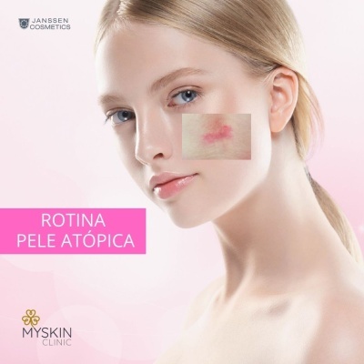 Kit Skincare Pele Atópica