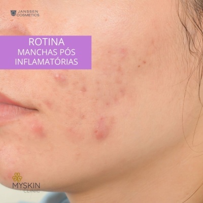 Kit Skincare Marcas e Cicatrizes