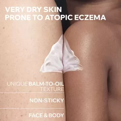 Braços claros e escuros com creme branco e texto sobre pele seca e eczema.