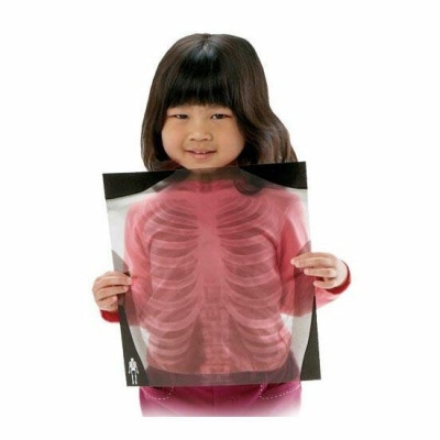 Radiografias do Corpo Humano