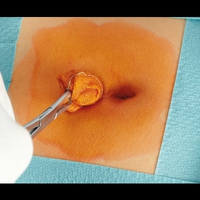 Antiséptico Cutasept Colorido