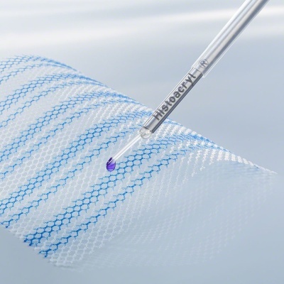 Sutura Líquida Histoacryl LapFix - Fixação de telas