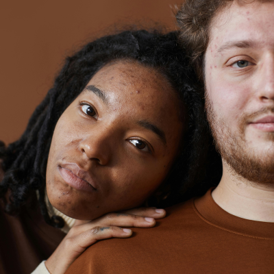 Creme de rosto pele irregular jojoba & benjoim 20g