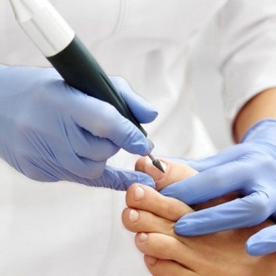 Profissional com luvas azuis fazendo tratamento em unha do pé com dispositivo elétrico