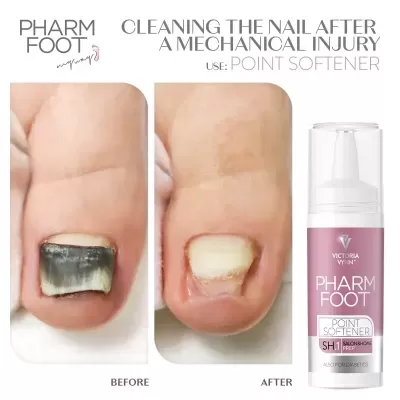 Pharm Foot Ureia - Point Softener 15ml