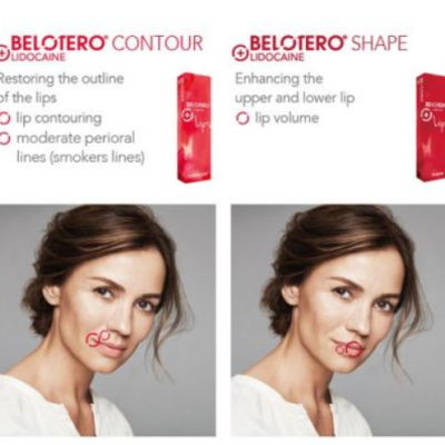 Belotero&#x20;Lips&#x20;Contour&#x20;1x0.6ml